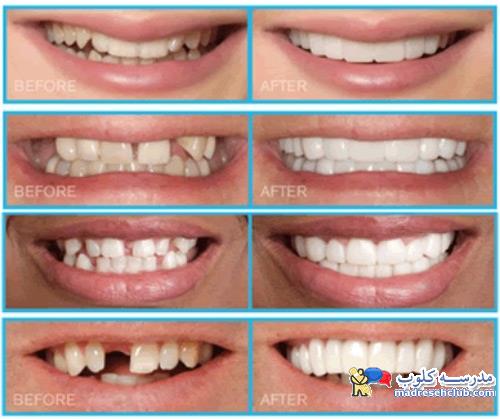 پلاک متحرک زیبایی اسنپ آن اسمایل چه مشکلاتی را اصلاح میکند؟